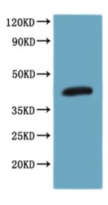 SDS-PAGE (CCR8-485H).jpg